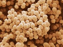 Staphylococcus Saprophyticus - Stock Image - B234/0182 - Science ...