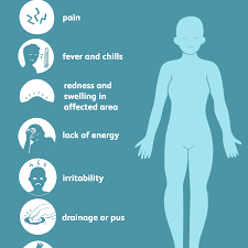 Osteomyelitis: Symptoms, Causes, Diagnosis and More