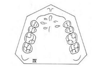 Examples of Kennedy’s Classification – Dentowesome