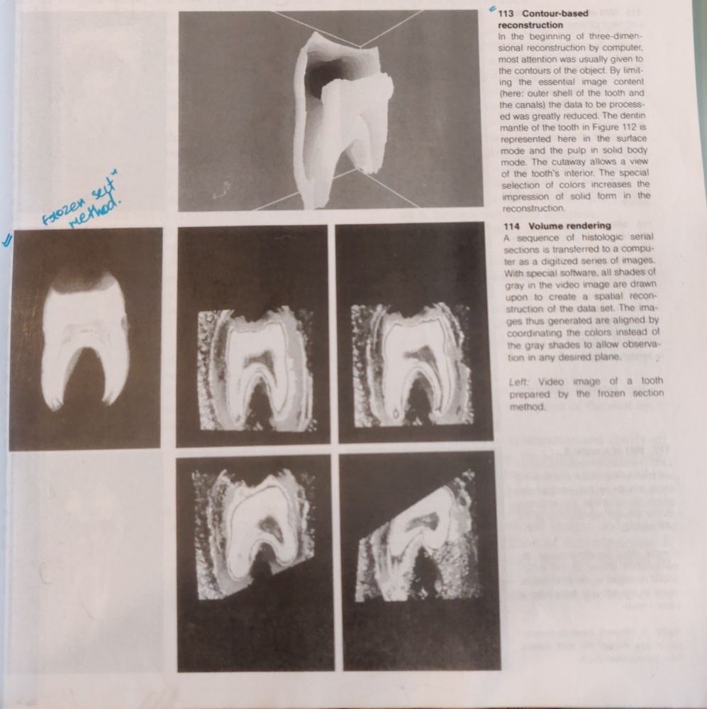 Visualization Endogram ENDODONTOLOGY – ANATOMY PART-I – Dentowesome