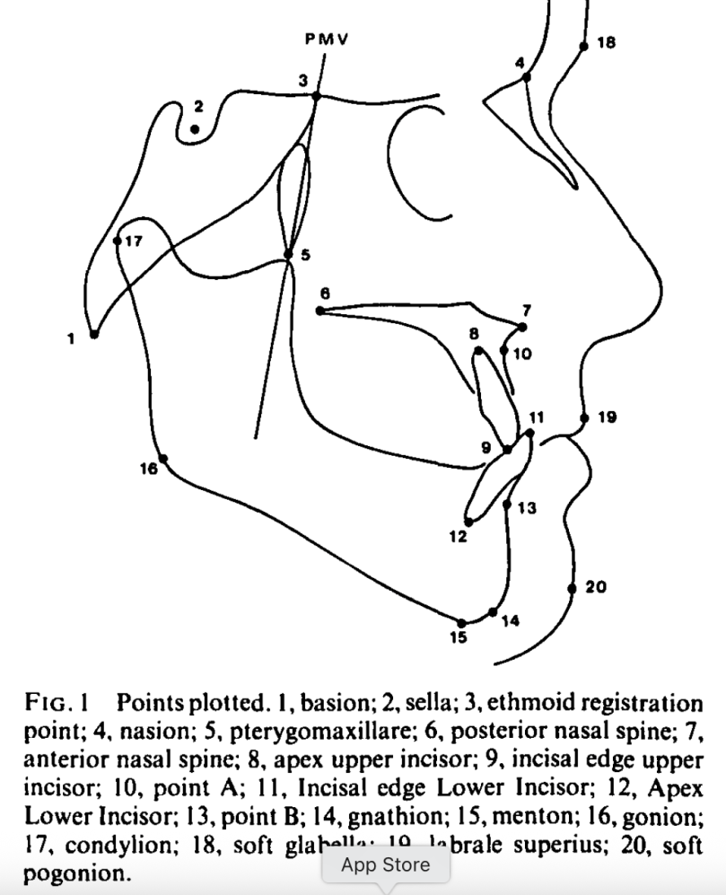 Class III Malocclusion: Surgery or Orthodontics? – Dentowesome